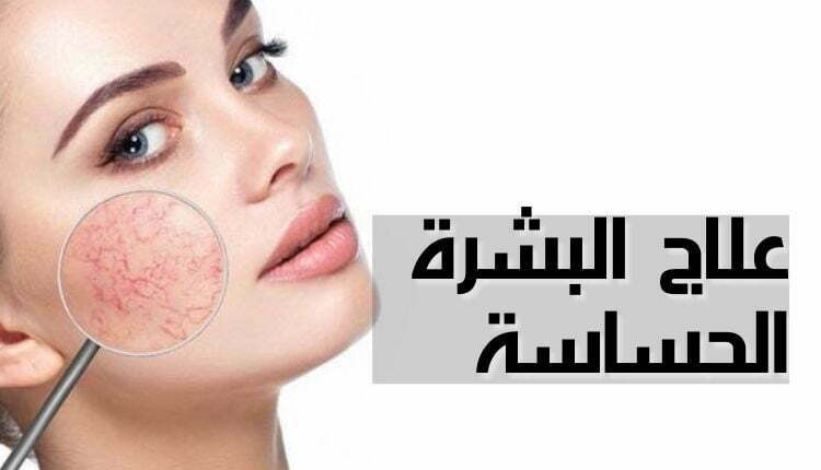 علاج البشرة الحساسة،Sensitive skin treatments