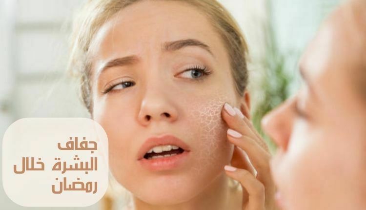 Dry skin during Ramadan جفاف البشرة خلال رمضان