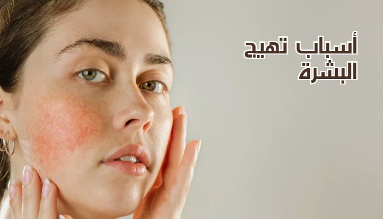 أسباب تهيج البشرة Causes of skin irritation وفي الصورة فتاة ذات بشرة متهيجة