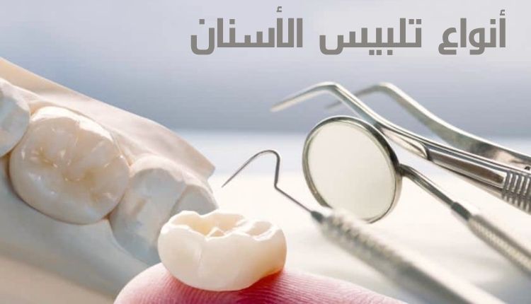 أنواع تلبيس الأسنان Types of dental crowns
